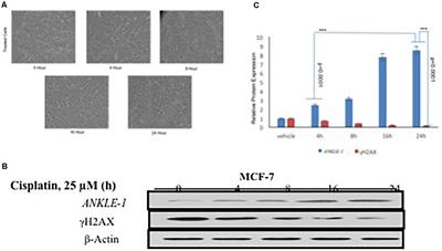 ANKLE1 as New Hotspot Mutation for Breast Cancer in Indian Population and Has a Role in DNA Damage and Repair in Mammalian Cells